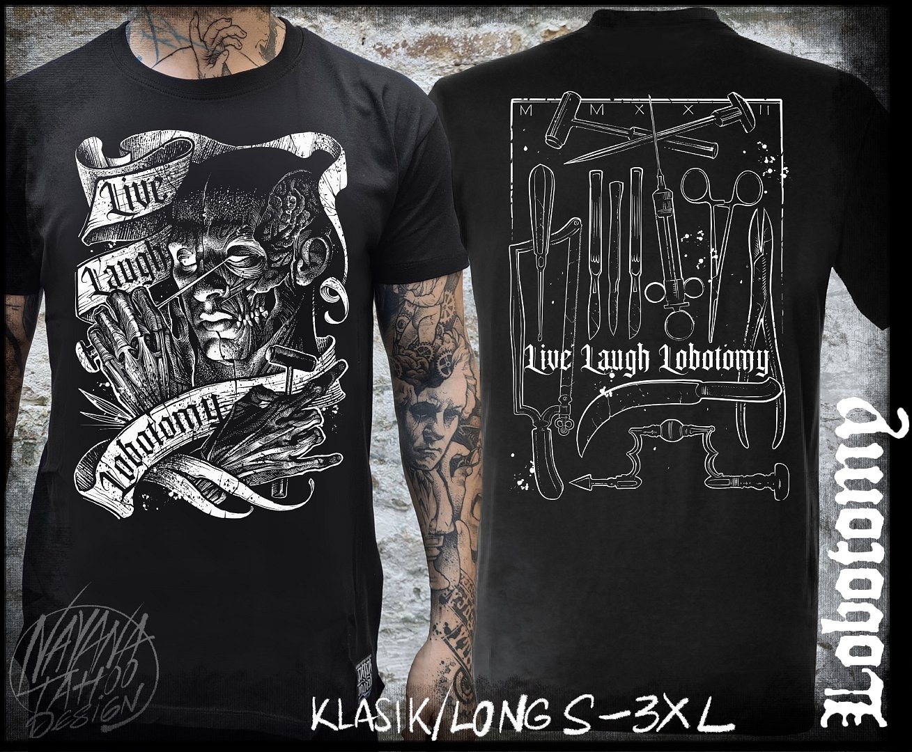 Lobotomy 2022